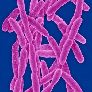 Flavobacterium acuario